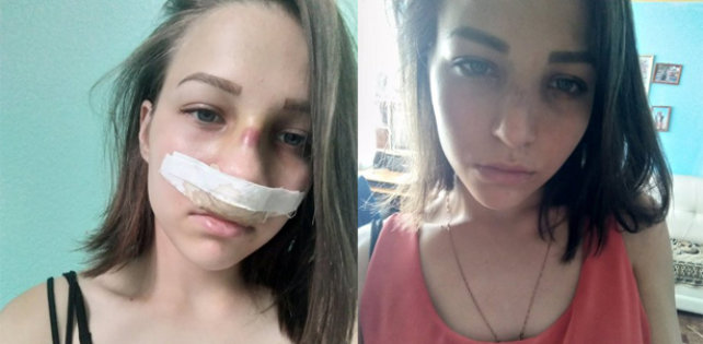 16-летняя девочка пришла на рэп-концерт в Уфе. В итоге ей сделали 2 операции 